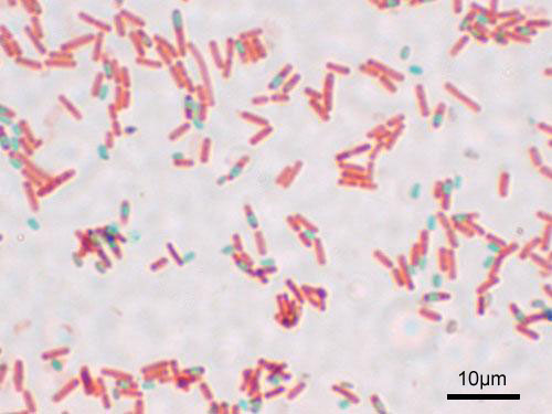 Endosporalar haqida